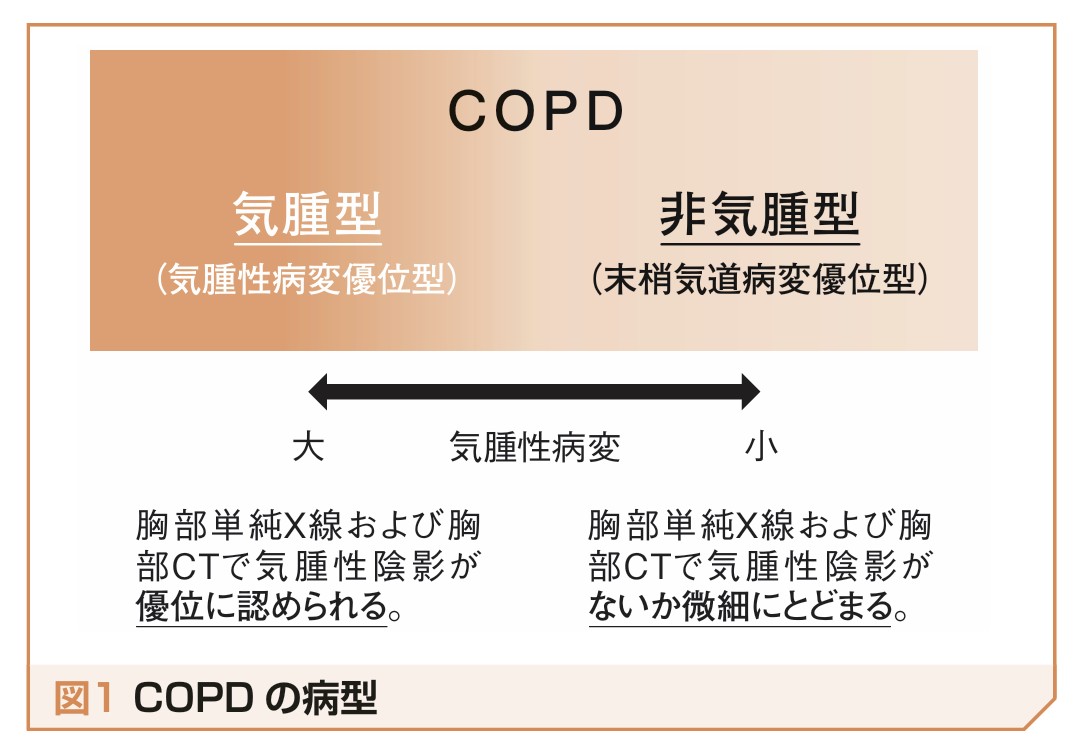 COPDの病型