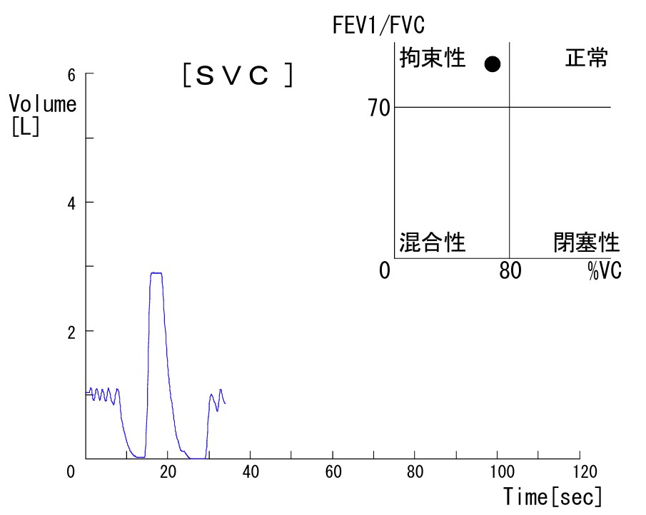 肺気量分画と換気分類図