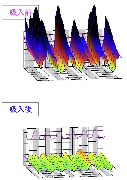 吸入前後のRrs
